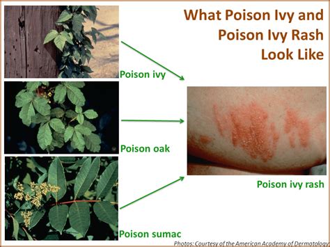 Navigating the Emotional Landscape: Coping with the Effects of Poison Ivy Rash Dreams