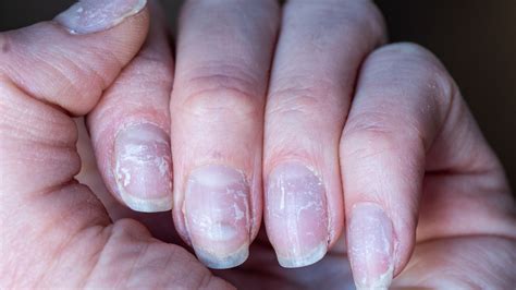 Peeling Away the Layers: Symbolic Meanings of Dismantling Manicures