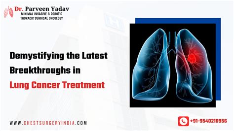 Pioneering Breakthroughs: Promising Advances in Lung Cancer Treatment