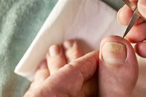 Possible Reasons Behind Having Dreams About Lengthy Hair on Toenails