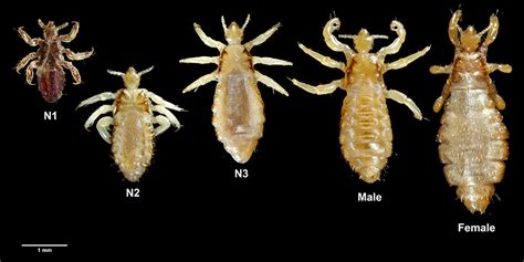 Potential interpretations based on the characteristics of the individual infested with lice