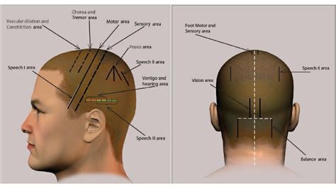 Practical steps to address underlying issues related to dreams of discomfort in the scalp region