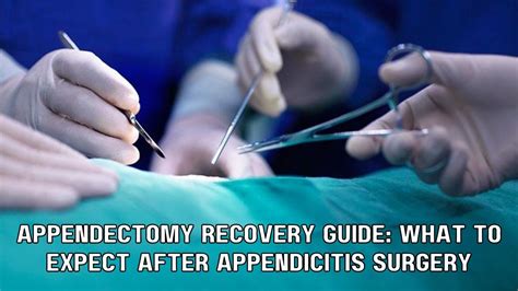 Preparing for Appendectomy: What to Expect