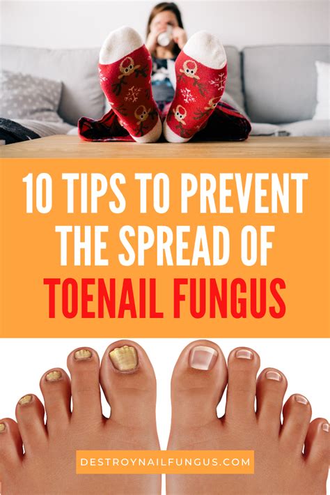 Prevention is Key: How to Keep Toe Fungus at Bay