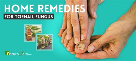 Prevention is Key: Tips for Avoiding Infections of the Fingernail and Toenail
