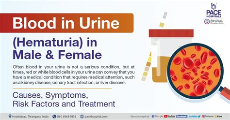 Preventive Measures to Lower the Risk of Hematuria in Dreams