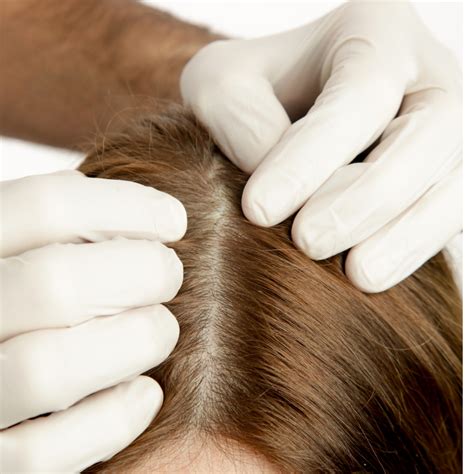 Promoting Hair Health: Tips and Techniques to Maintain a Healthy Scalp and Prevent Hair Thinning