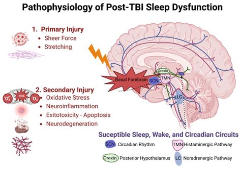 Psychological Factors Influencing Dreams of Automotive Accidents