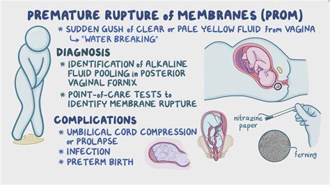 Psychological Perspective on Dreams Associated with the Rupture of Fluids during Maternity