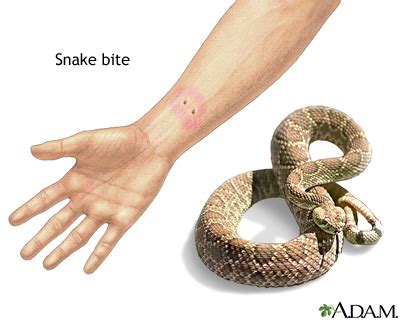 Psychological Significance Linked to Vision of Serpent Bite on Lower Limb