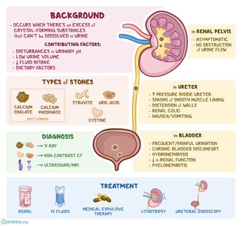 Recognizing Kidney Stones: A Common Source of Hematuria