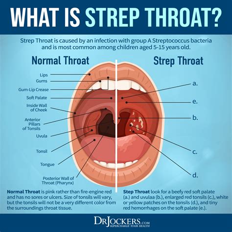 Recognizing Signs of Throat Affliction