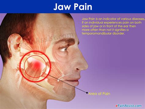 Recognizing Symptoms of an Inflamed Mandible