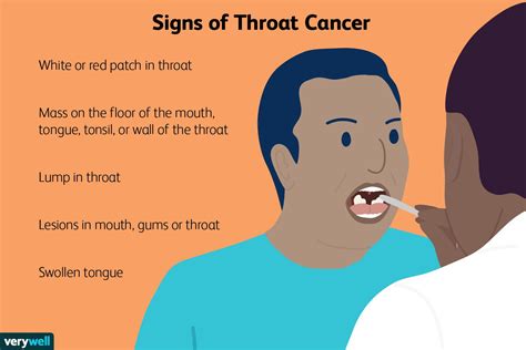 Recognizing the Early Signs and Symptoms of Throat Cancer