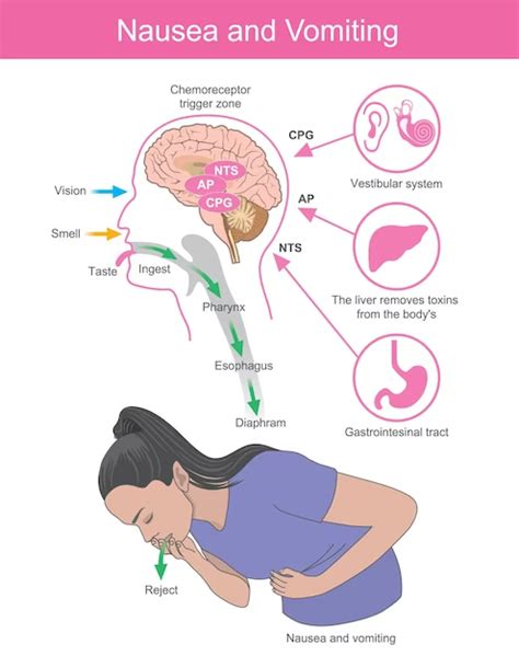 Recognizing the Early Symptoms of Motion Induced Nausea