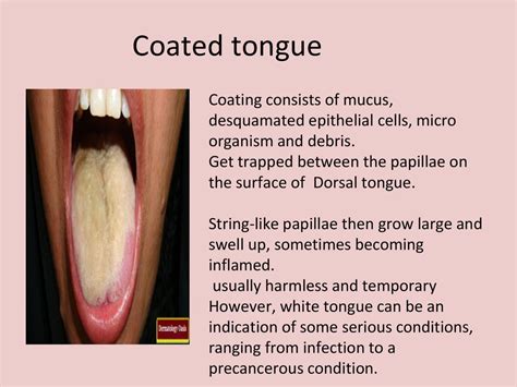 Recognizing the Indications of Tongue Infection: Indications to Be Cautious About