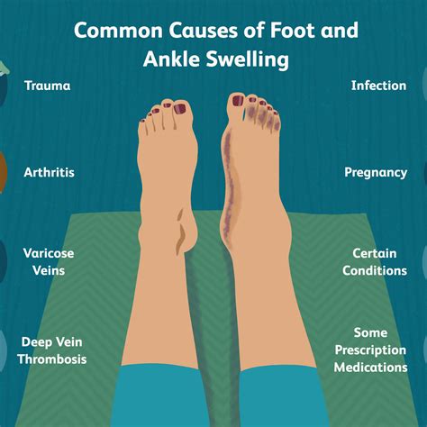 Recognizing the Symptoms: A Clue to Identifying Swelling in the Feet