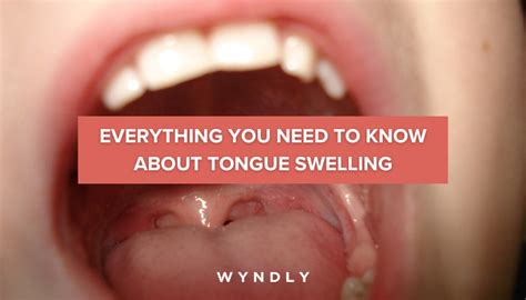 Recognizing the Symptoms: When Tongue Swelling Becomes Noticeable