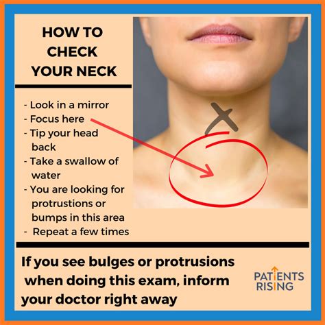 Recognizing the Symptoms Associated with Neck Lumps