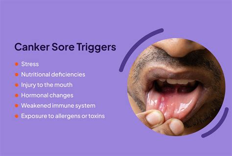 Recognizing the Symptoms of Tongue Sores: When to Seek Medical Help