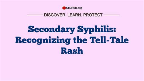 Recognizing the Tell-Tale Indications of Candidiasis