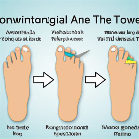 Recovery Expectations after Toe Enhancement: Timeline and Tips