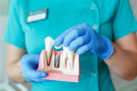 Recovery and Aftercare: What to Expect post Tooth Implant Procedure