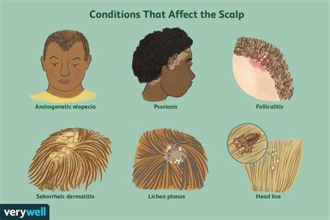 Revealing the Indications and Manifestations of Conditions Affecting the Scalp