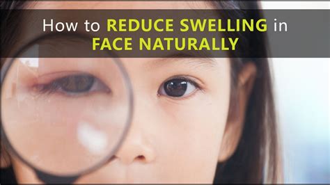 Revealing the Remedies: How to Treat and Prevent Facial Swelling