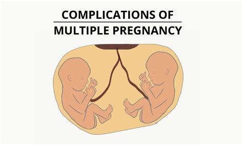 Risks and Challenges: Multiple Pregnancy and its Potential Impact on Dream Patterns