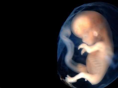 Scientific Explanations: Understanding the Origins of Dreaming About the Unborn Baby's Heartbeat