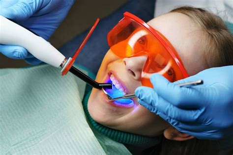 Seeking Professional Advice for Cavities: When to Consult a Dentist