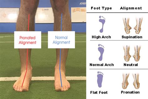 Significance of Wearing Shoes on an Inaccurate Foot Placement: An Insight into its Psychological Implications