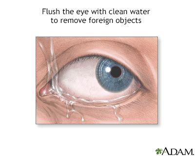 Significance of a Foreign Object in the Eye: Does It Indicate Potential Hazard?