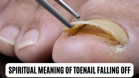 Spiritual and Mystical Significance of Elongated Toenails in the Realm of Dreamscapes