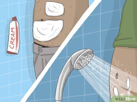 Step-by-Step Instructions for the Removal of Abdominal Hair