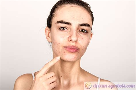 Steps to Embrace and Interpret Dreaming of Acne as a Positive Sign