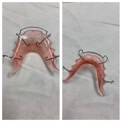 Straight from the Lab: Understanding the Construction of Hawley Retainers