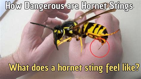 Taking Action: What to Do If You Experience a Hornet Sting in Your Dream