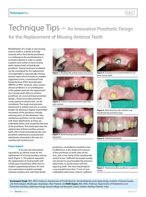 Techniques for Recognizing and Interpreting Personal Context in Dreams about Missing an Anterior Incisor