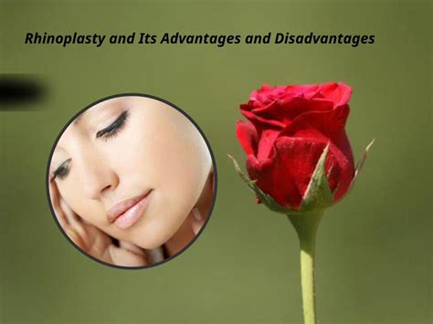 The Advantages and Disadvantages of Rhinoplasty: Is It Worth It?