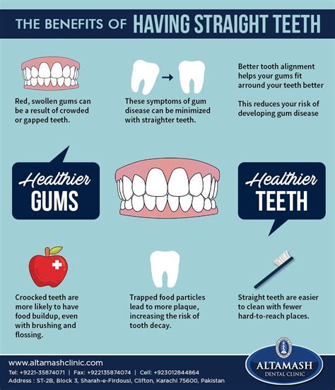 The Advantages of Having Straight Teeth