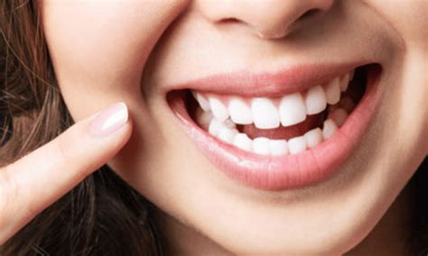 The Benefits of Having Properly Aligned and Brilliantly Bright Teeth