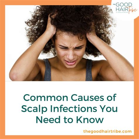 The Common Causes of Scalp Infections