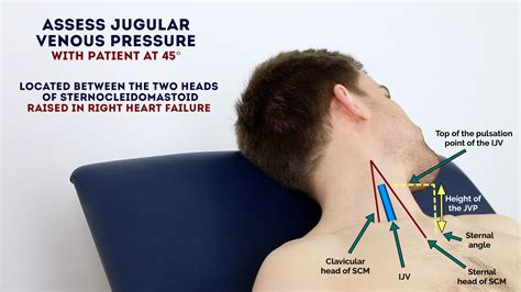 The Connection Between Ascending Tools and Elevation in the Examination of Dreams