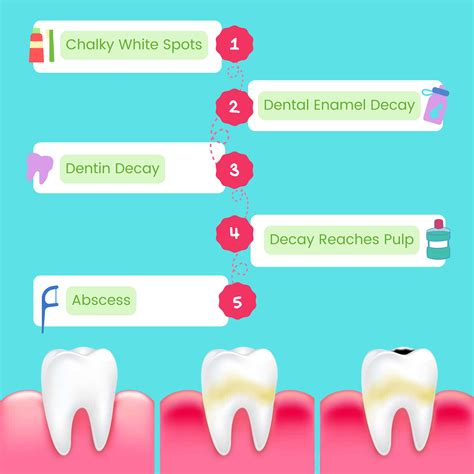 The Connection between Nightmares of Tooth Decay and Dread of Mortality