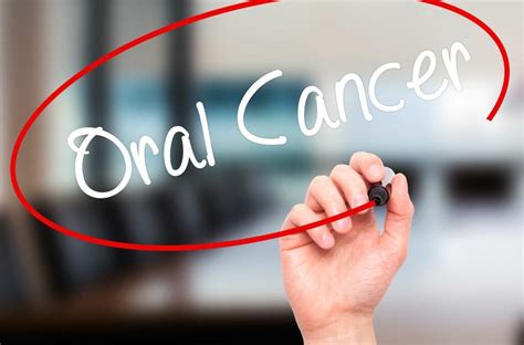 The Crucial Role of Awareness: Exploring the Understanding of Oral Cancer