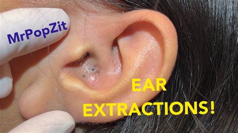 The Cultural and Historical Context of Ear Extractions in Dream Interpretation