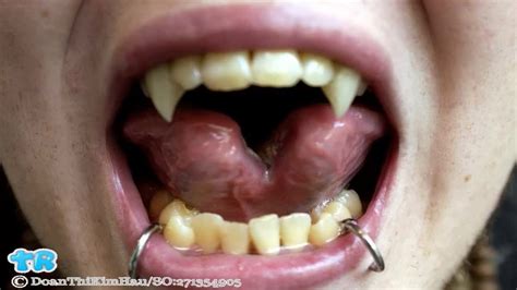 The Dangers and Precautions associated with Split Tongue Procedures