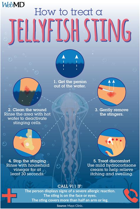 The Enchanting World of Jellyfish Stings